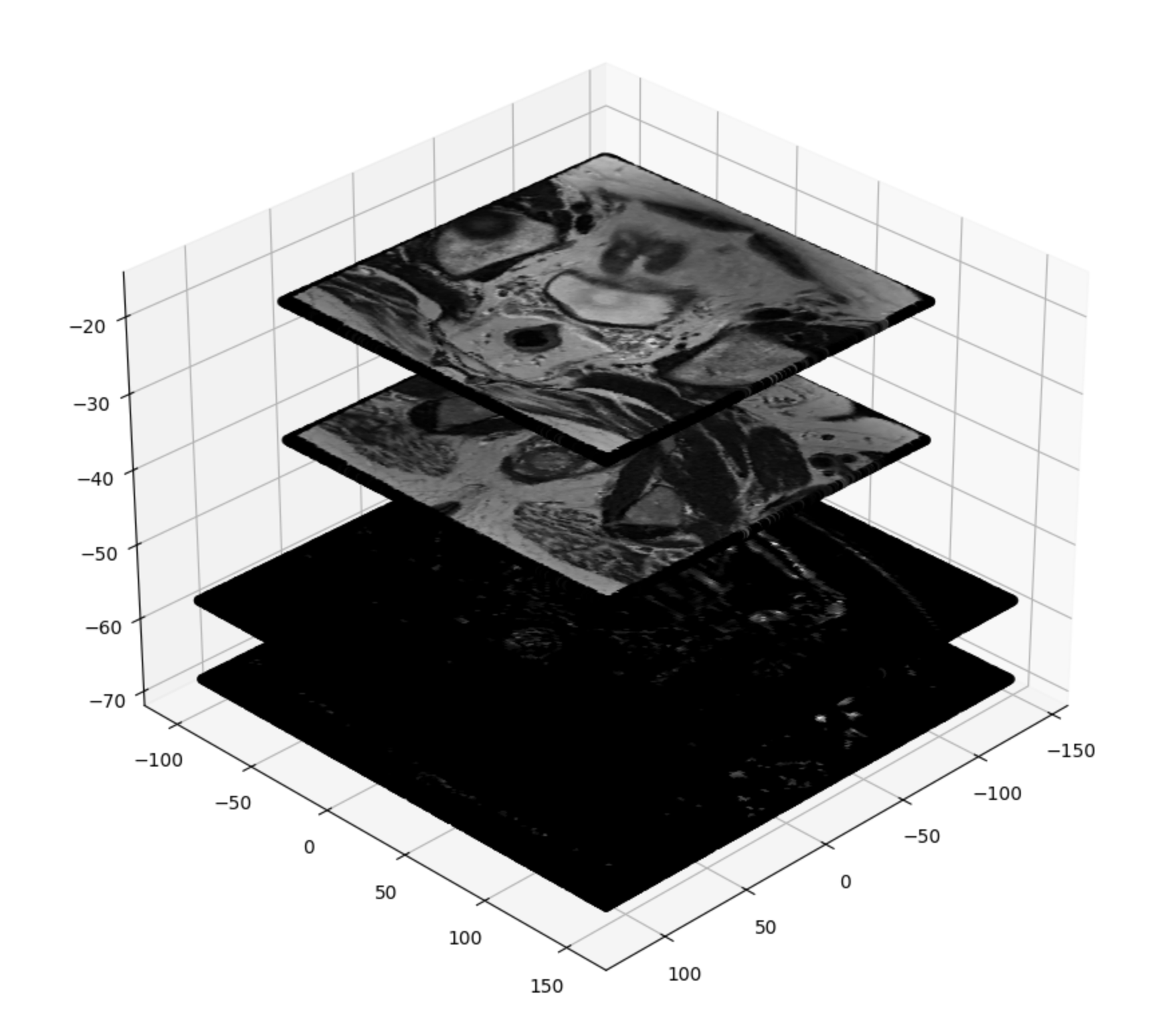 MRI-Sample